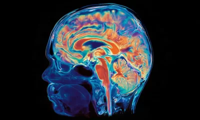 Estudio revela desarrollo dual del cerebro humano