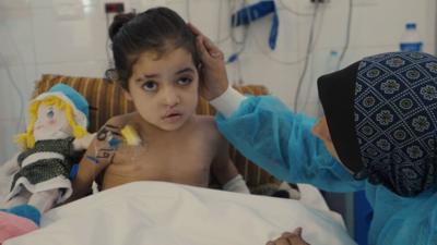 Niña de Gaza sufre múltiples cirugías tras ataque aéreo israelí