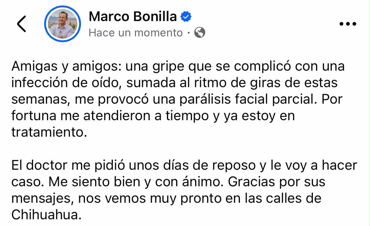 Marco Bonilla suspende actividades por parálisis facial parcial