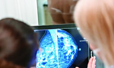 Inteligencia artificial para evaluar riesgos de cáncer mediante selfies