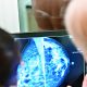 Inteligencia artificial para evaluar riesgos de cáncer mediante selfies