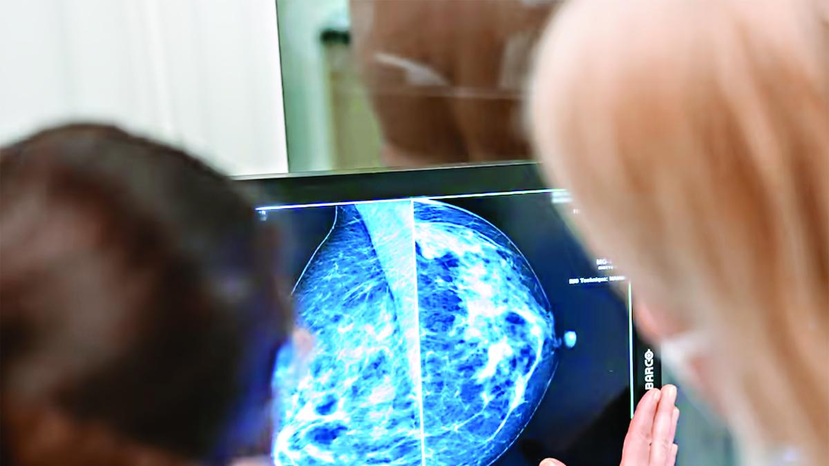 Inteligencia artificial para evaluar riesgos de cáncer mediante selfies