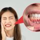 Recesión gingival: un problema que afecta la salud bucal